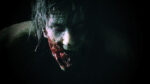 Resident Evil 2 (Xbox One) - immagine 4